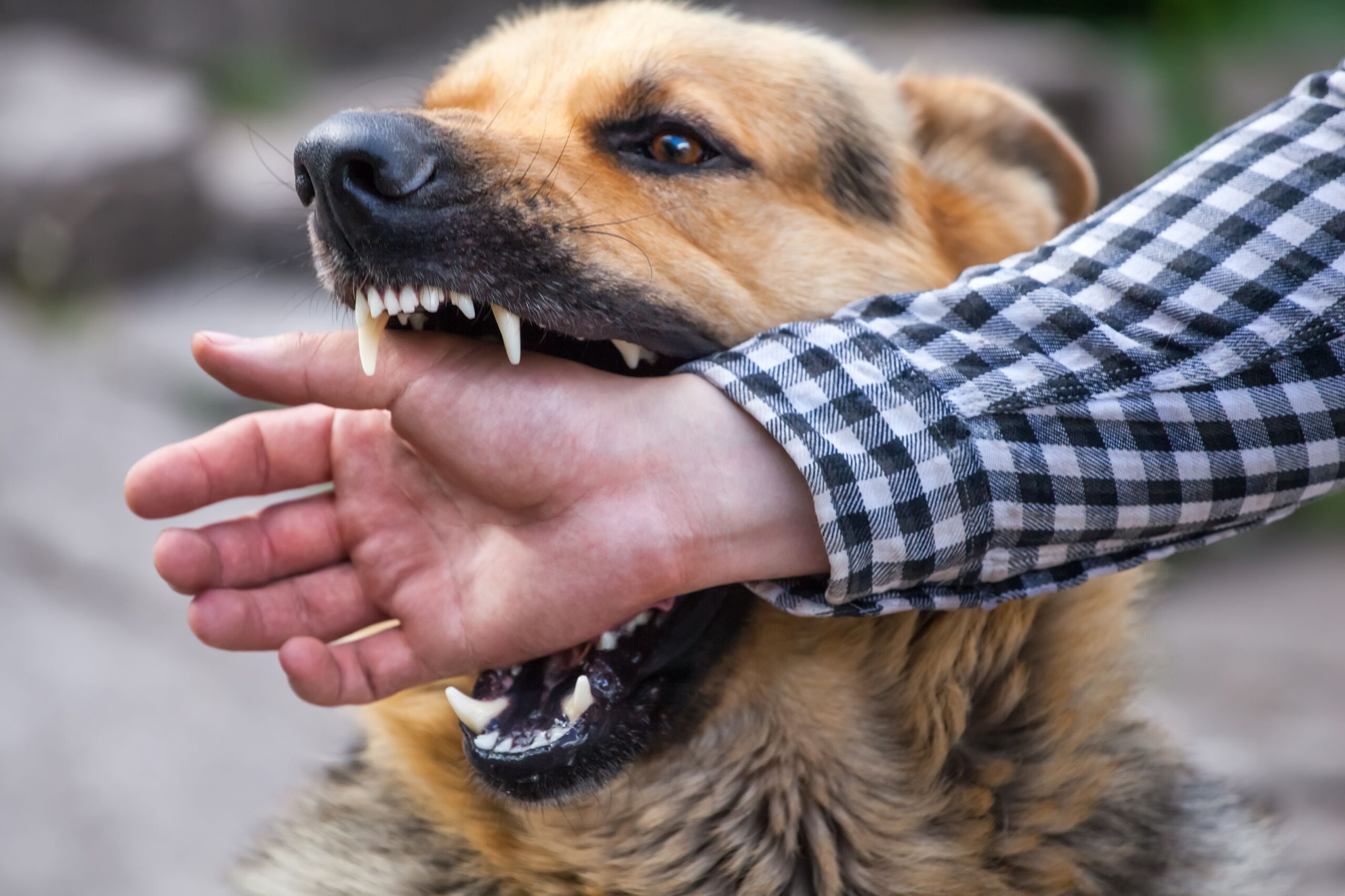 dog-biting-human-hand