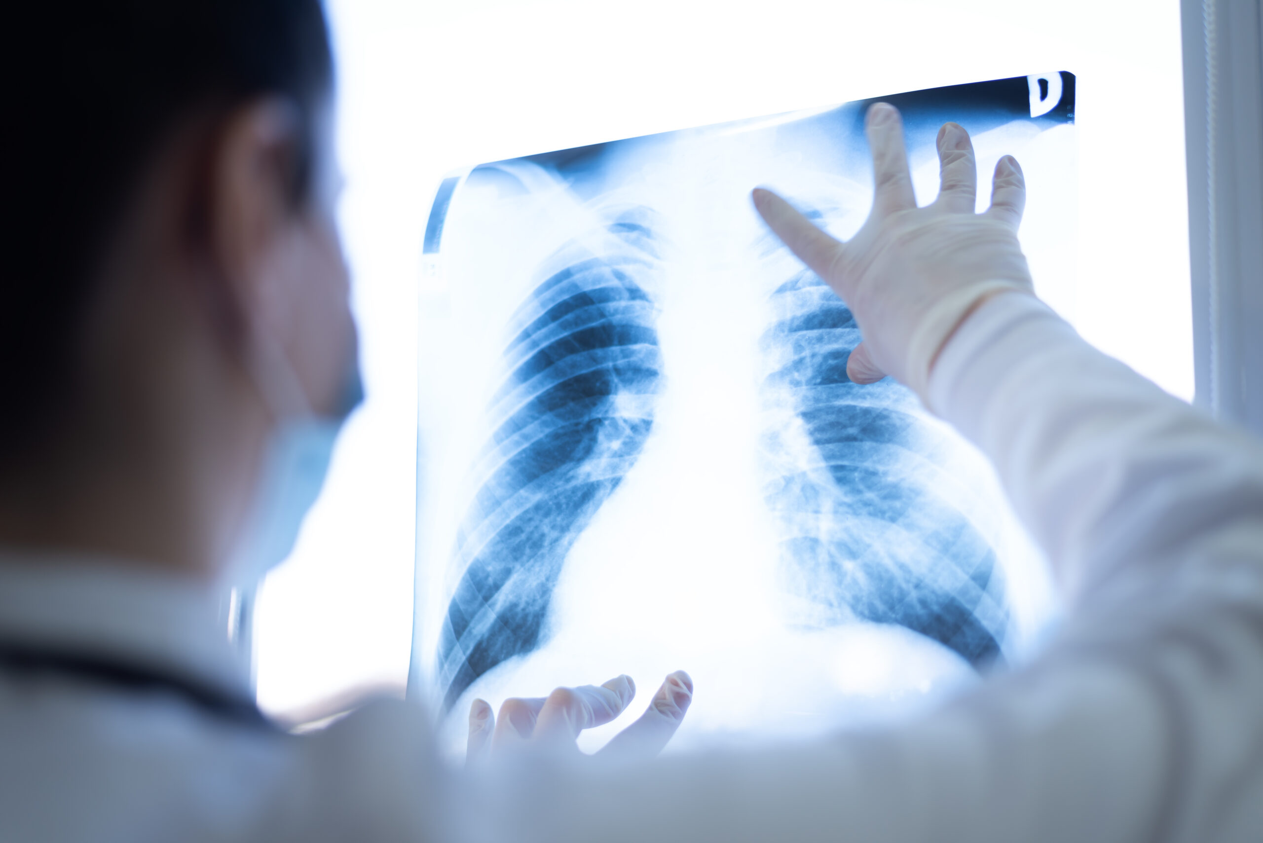 Delayed Cancer Diagnosis